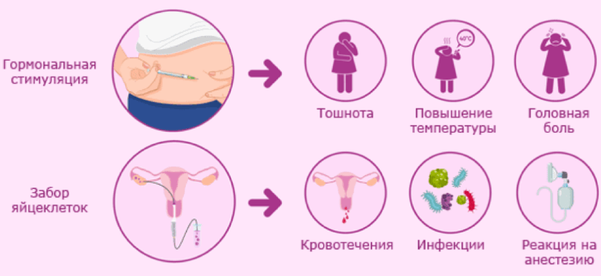 Женщина сдаёт яйцеклетку — стимуляция, пункция, взятие ооцитов